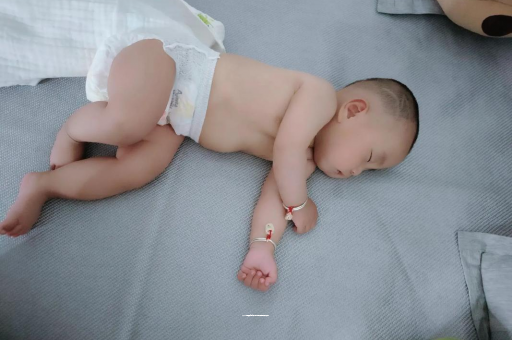 黔东南六个月宝宝眼睛散光